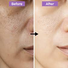 Glowrah Whitening Cream